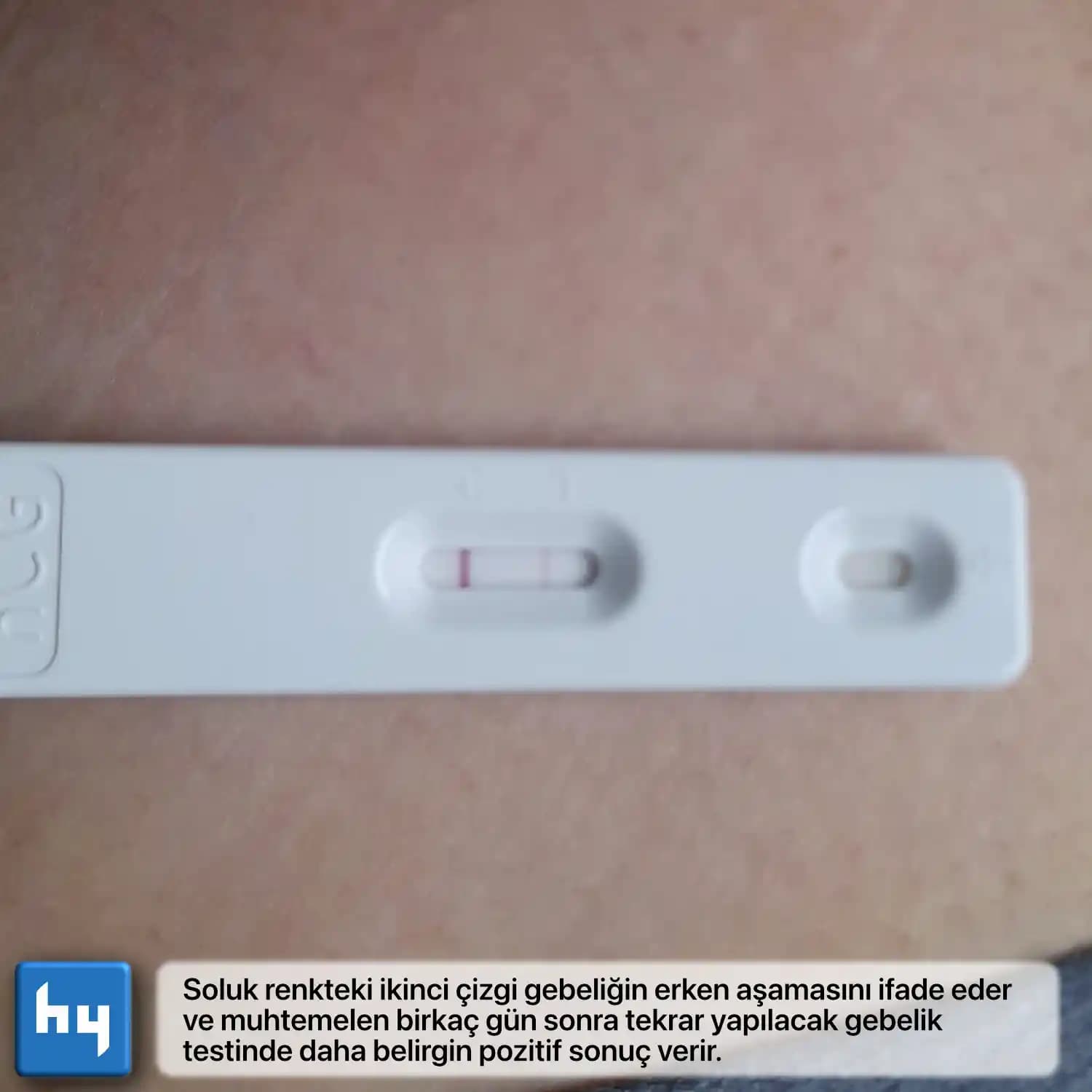 Erken Gebelik Testi Ne Zaman Sonuç Verir? Güvenilir Zamanlama ve Doğru Sonuçlar İçin Rehber