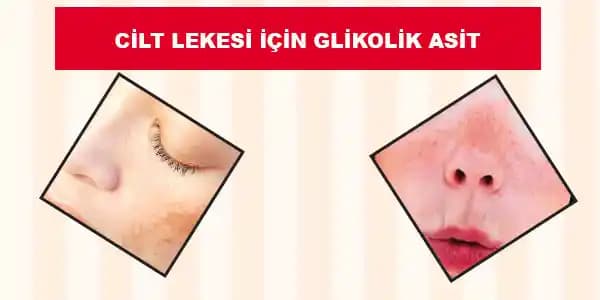 Glikolik Asit Sonrası Doğru Bakım Adımları ve Cilt Sağlığını Koruma Yöntemleri