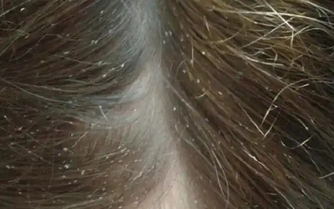 Gözeneklerin Görünümünü Azaltan Etkili Kozmetik ve Cilt Bakım Yöntemleri