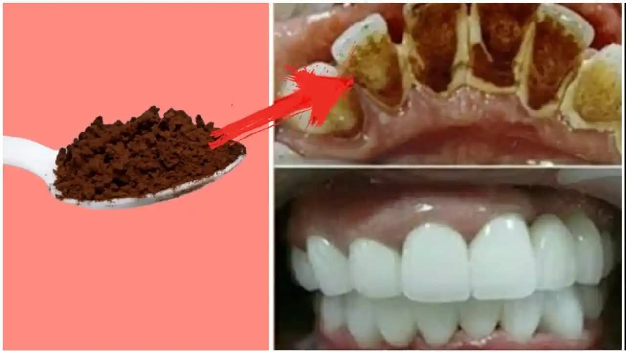 Kahve ile Diş Beyazlatma Yöntemleri ve Doğal Alternatifler