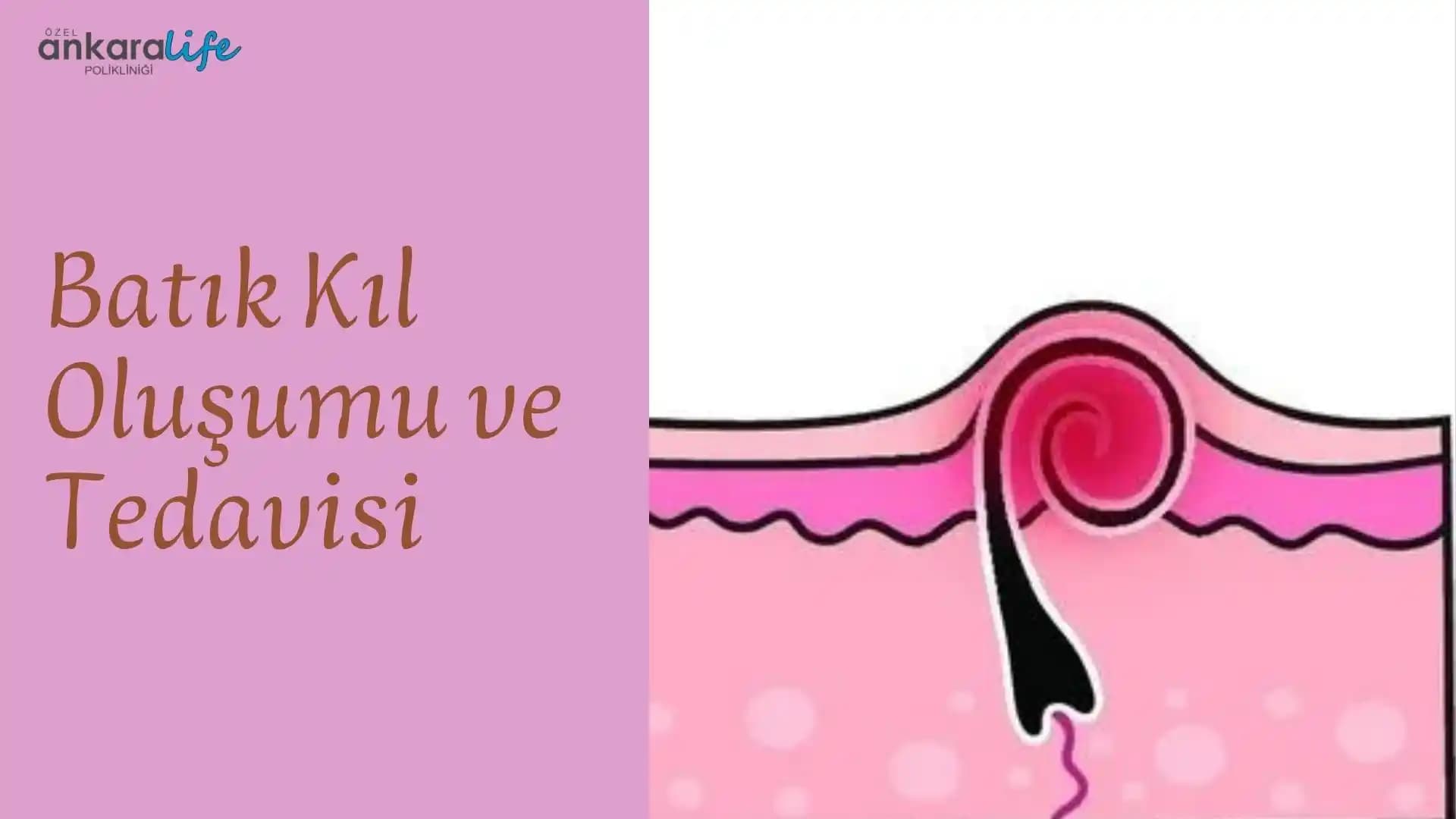 Kıl Batıkları Nasıl Giderilir ve Önlenir: Etkili Yöntemler ve Doğal Çözümler