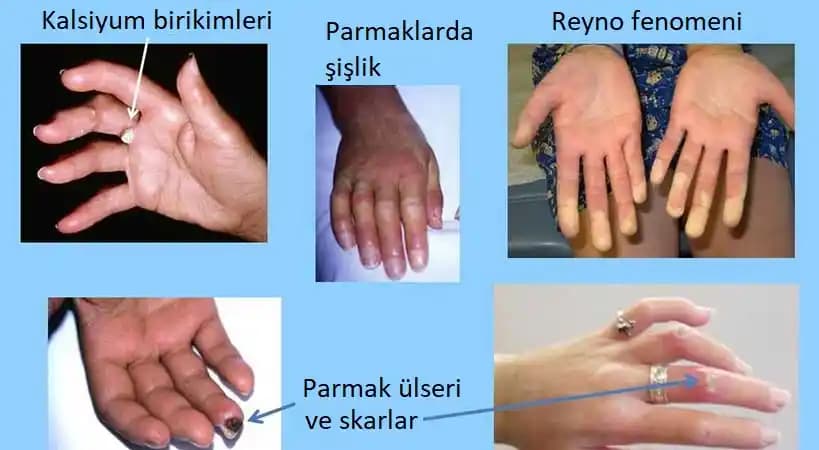 Kozmetikte Derma Kelimesinin Anlamı ve Güncel Kullanım Alanları Hakkında Bilgi