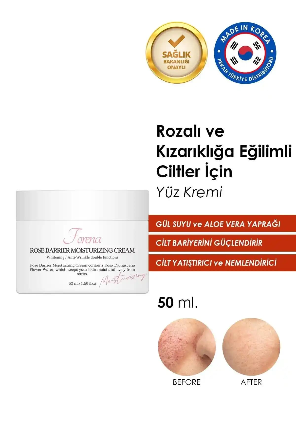 Rozalı Ciltler İçin Uygun Krem ve Bakım Rehberi: Doğru Ürün Seçimi ve İpuçları