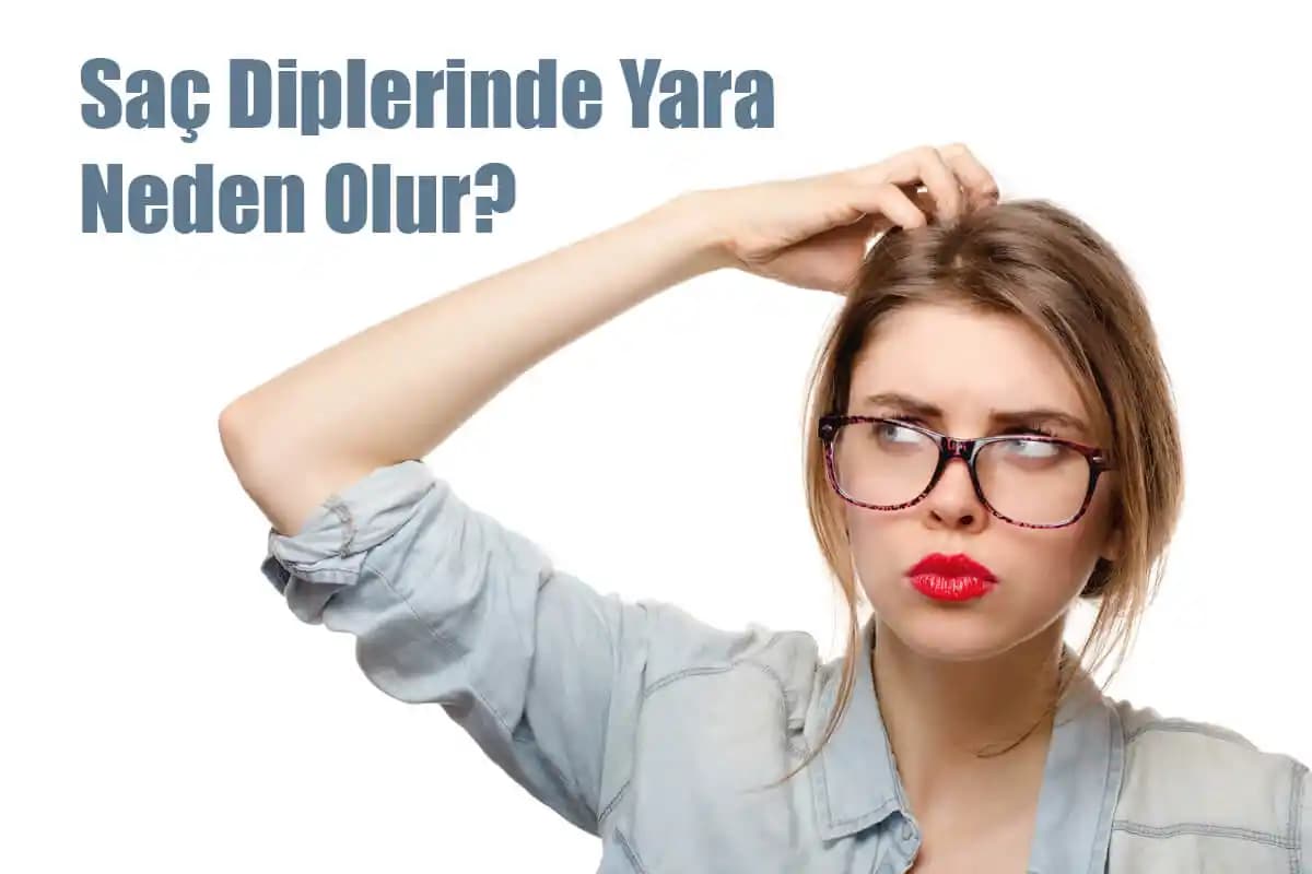 Saç Diplerindeki Yaraların Nedenleri ve Korunma Yöntemleri Hakkında Detaylı Bilgi