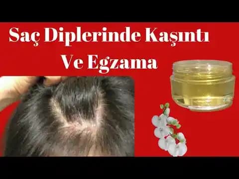 Saçlarda Pullanma Nedenleri, Belirtileri ve Etkili Çözüm Yolları