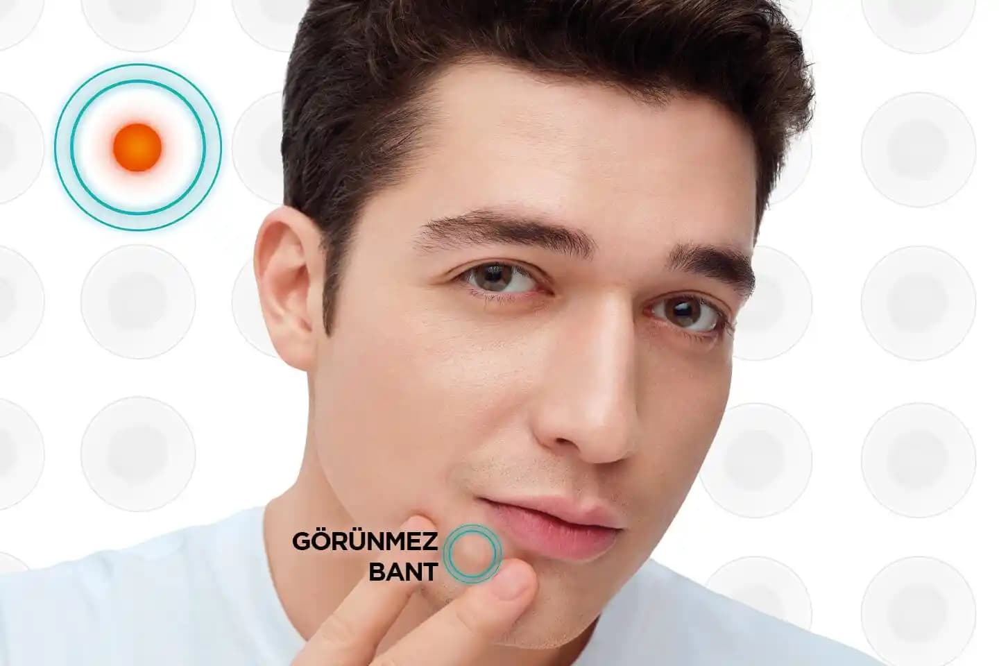 Sivilce Bandı Nedir ve Cilt Sağlığına Etkileri Nelerdir