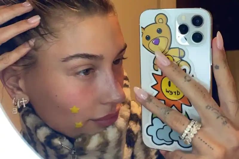 Sürekli Aynı Bölgede Çıkan Sivilcelerin Nedenleri ve Etkili Çözüm Yolları