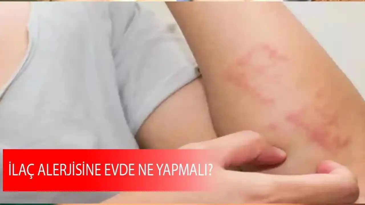 Takı Alerjisine Evde Çözüm: Güvenli ve Sağlıklı Takı Kullanımı Rehberi