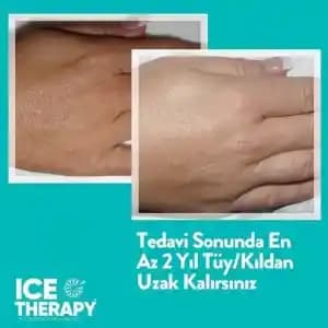 Tüy Dökücü Kremler: Etkili Mi, Nasıl Kullanılır ve Nelere Dikkat Edilmeli?