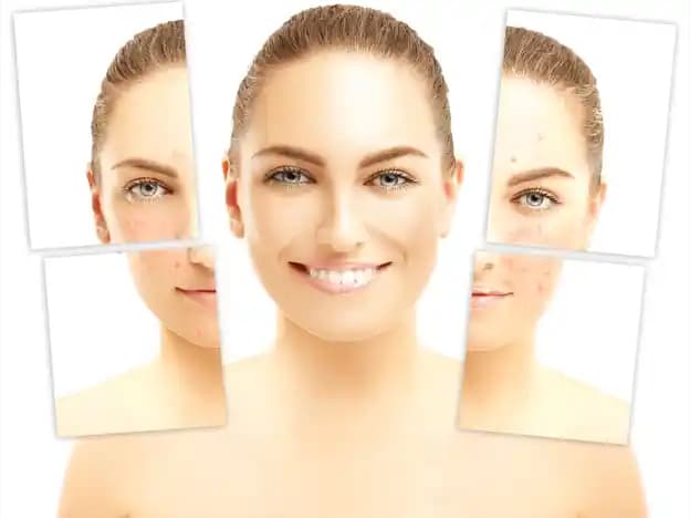 Yüz Alerjisi ve Kozmetik Ürünleri: Belirtiler, Nedenler ve Korunma Yöntemleri