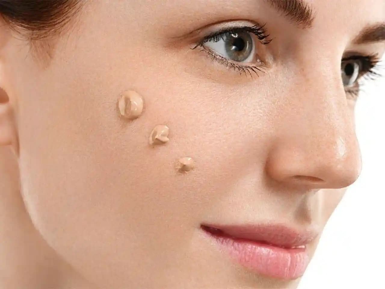 Yüzdeki Benler: Estetik ve Sağlık Açısından Güncel Yaklaşımlar ve Tedavi Seçenekleri