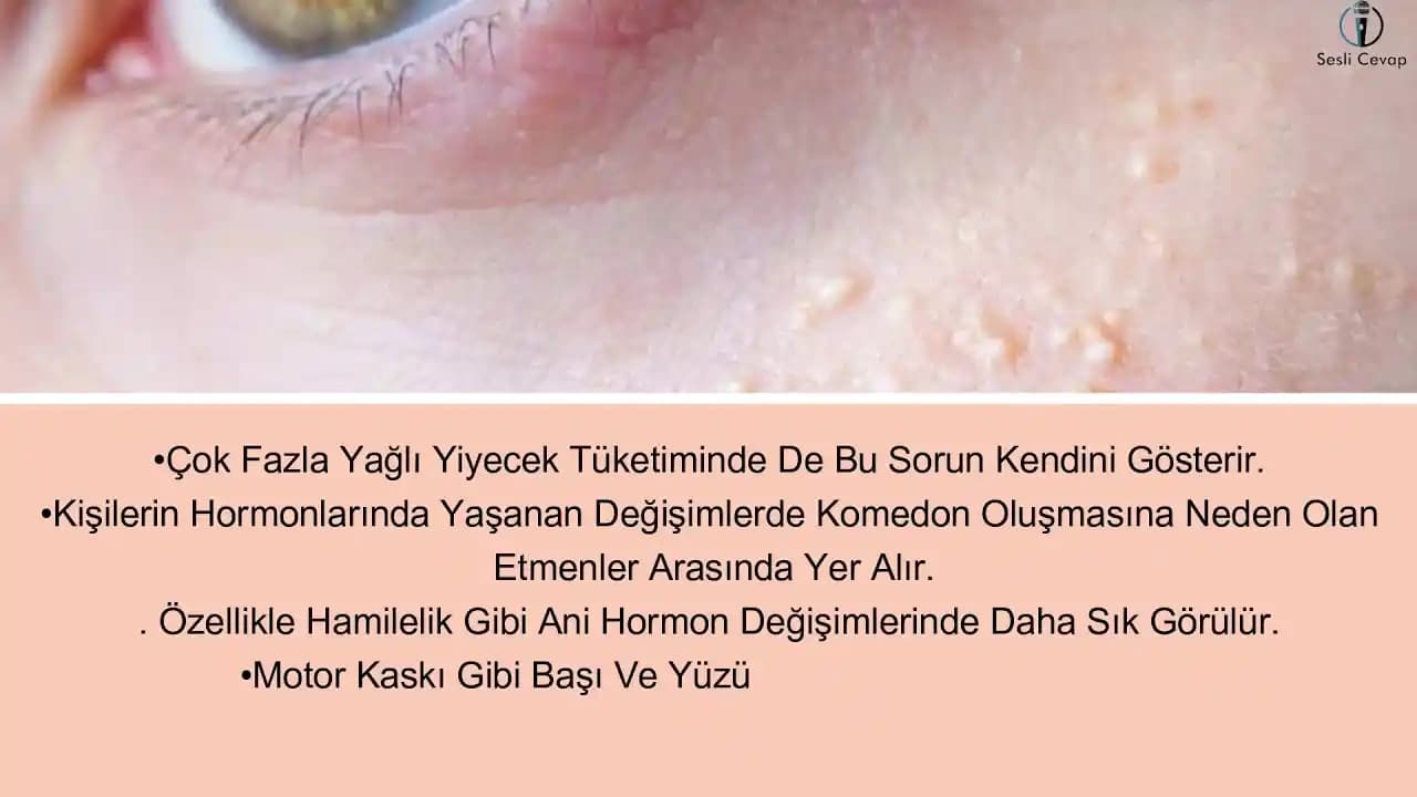 Yüzdeki Komedonların Nedenleri ve Etkili Önleme Yöntemleri