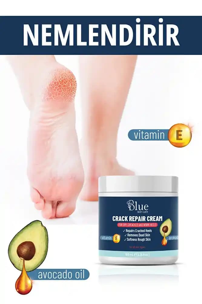 Ayak Mantarı Tedavisinde Krem Kullanımı: Etkili ve Doğru Uygulama Yöntemleri