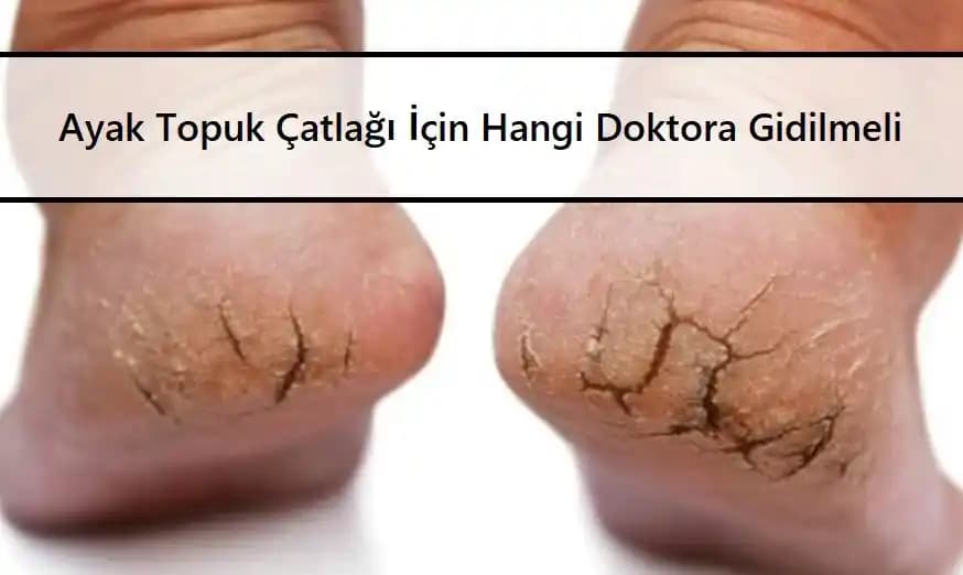 Ayak Topuklarının Çatlaması: Nedenleri, Riskleri ve Etkili Bakım Önerileri