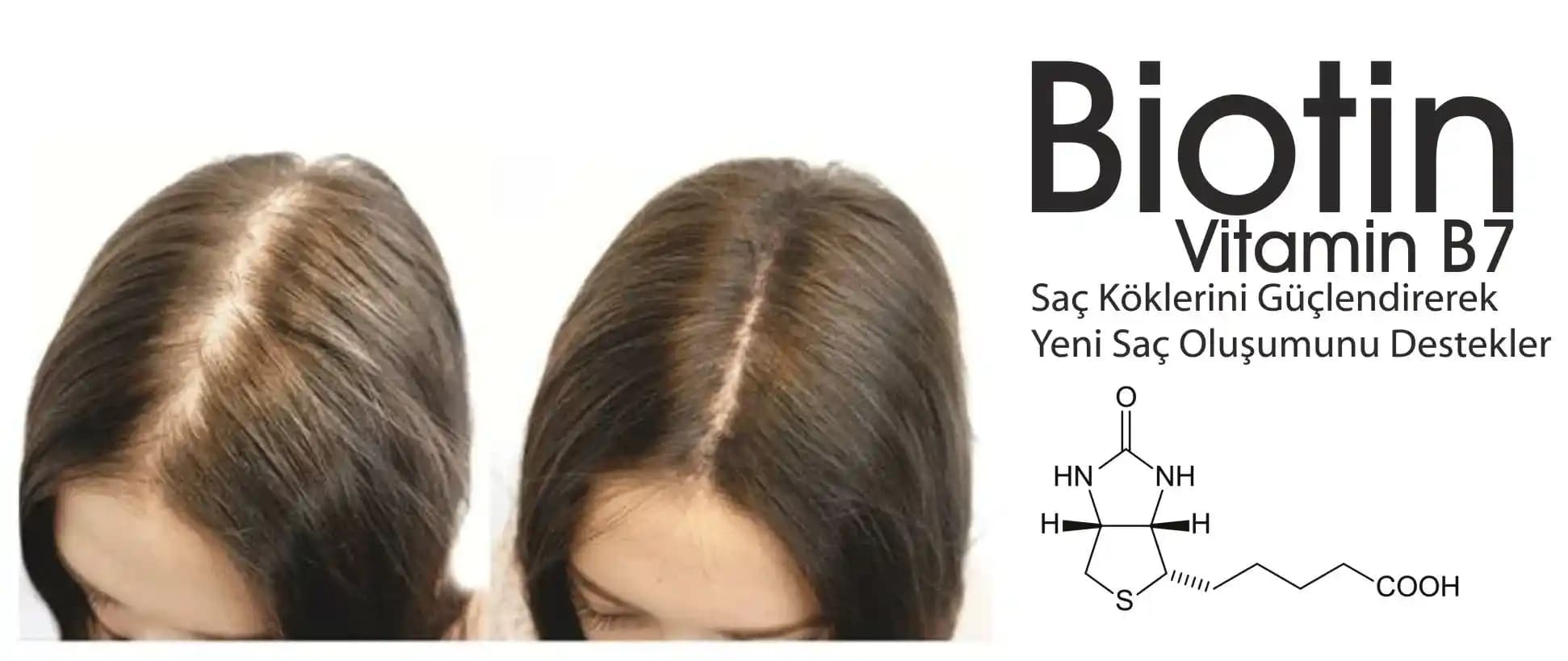 Biotin ve Saç Sağlığı: Mevcut Veriler Işığında Etkiler ve Kullanım Değerlendirmesi