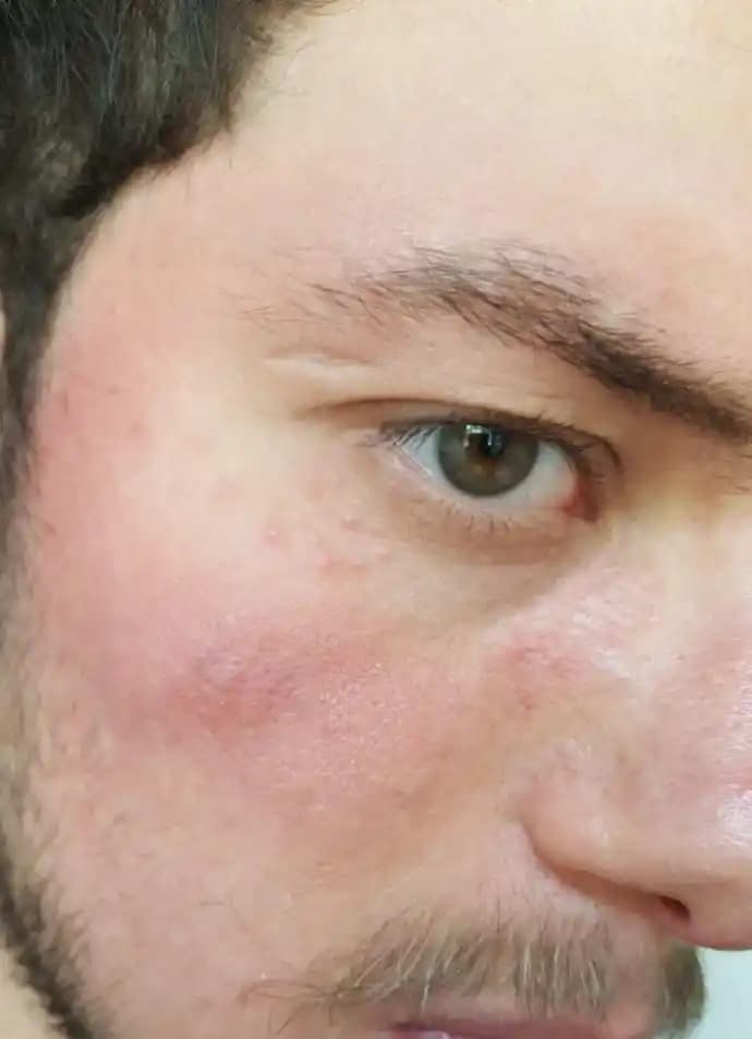 Deri Dökülmesi Nedenleri ve Mevcut Bilgi Kısıtlılığı Üzerine Kısa Bir Analiz