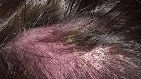 Kafa Derisinde Kızarıklık: Arama Sonuçlarının Yetersizliği ve Doğru Bilgi Rehberi