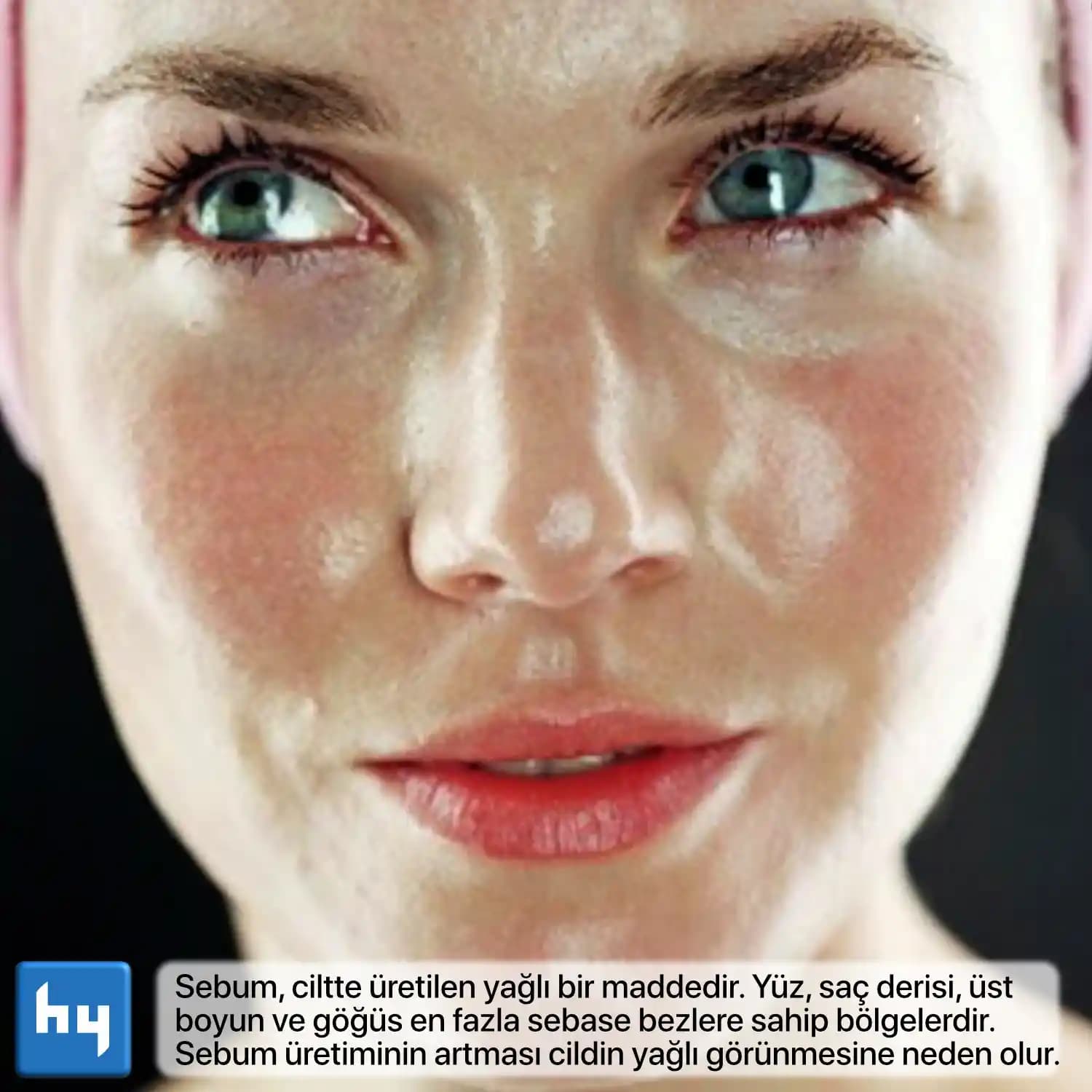 Aşırı Yağlı Yüzler İçin Nedenler, Bakım Yöntemleri ve Doğal Çözümler