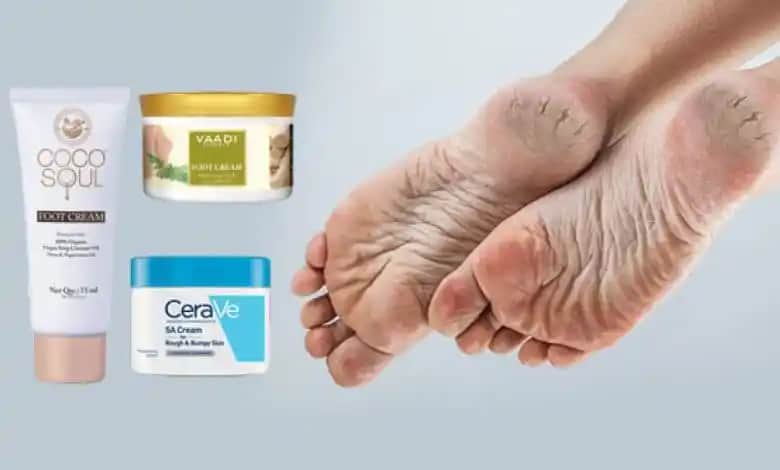 Ayak Çatlaklarına Karşı En Etkili Kremler ve Bakım Yöntemleri Rehberi