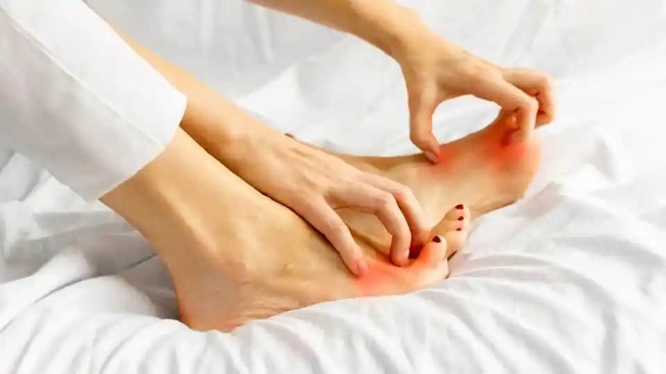 Ayakta Koku Neden Olur ve Etkili Çözüm Yolları Hakkında Detaylı Bilgi