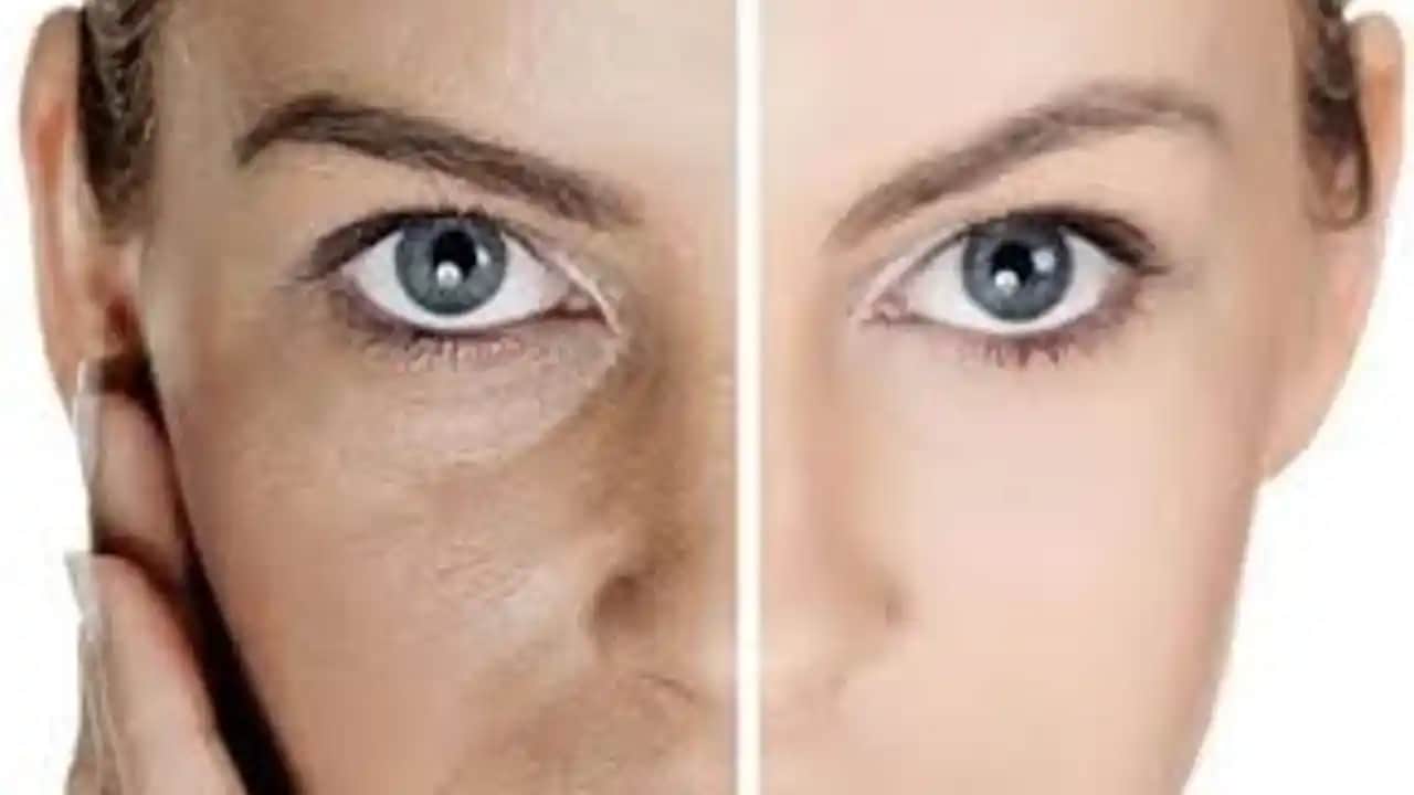 Burun Gözenekleri ve Cilt Sağlığı: Geniş Gözenekleri Azaltmanın Etkili Yolları