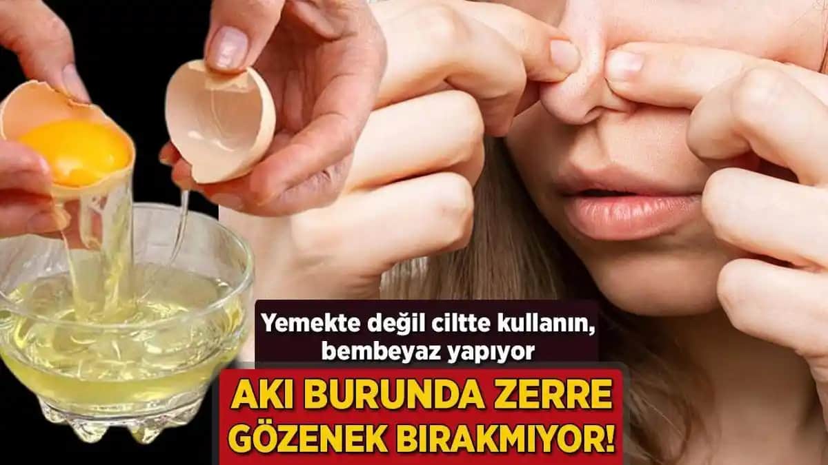 Burun Gözeneklerini Temizleme ve Geliştirme Yöntemleri: Sağlıklı ve Parlak Bir Cilt İçin İpuçları