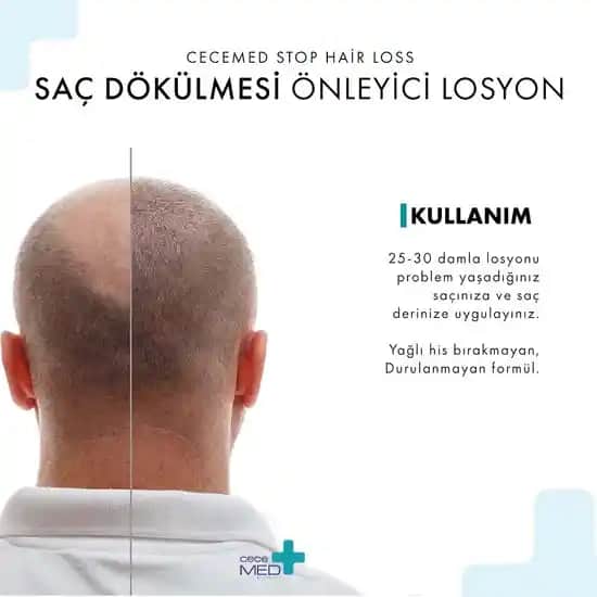 CeceMed Losyonları ile Saç Dökülmesine Karşı Güçlü ve Etkili Çözümler
