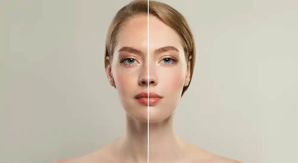 Cilt Tonu Beyazlatma Yöntemleri ve Sağlıklı Cilt Bakımı İpuçları