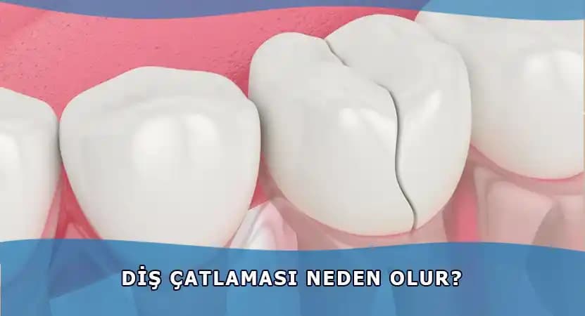 Ciltte Çatlaklar Nedir ve Önleme Yöntemleri Hakkında Detaylı Bilgi
