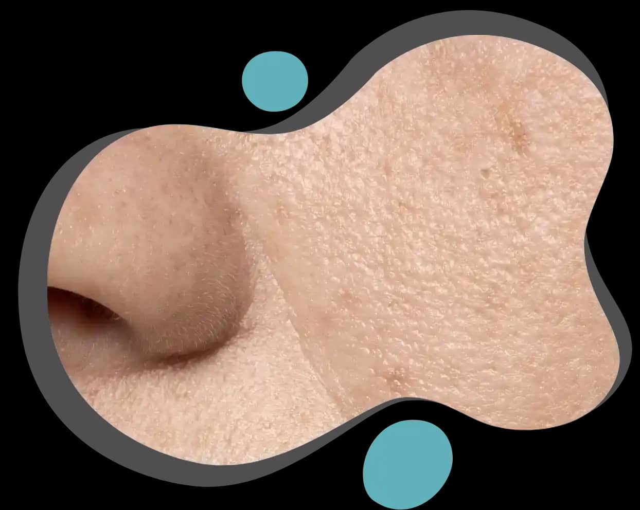 Ciltte Gözeneklerin Sağlıklı ve Estetik Görünümünü Koruma Yöntemleri