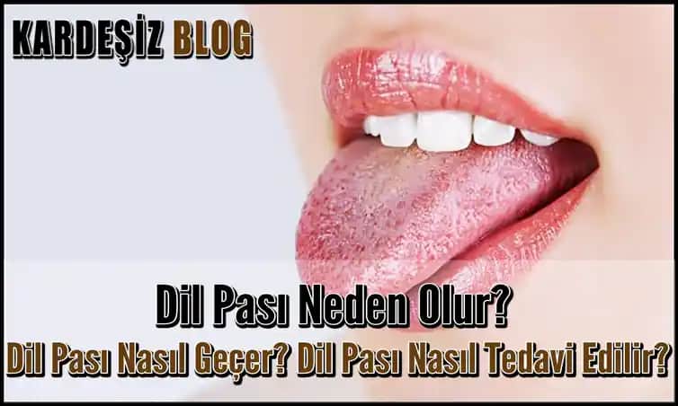 Dil Pasını Önleme ve Ağız Sağlığını Koruma Yöntemleri Hakkında Kapsamlı Rehber