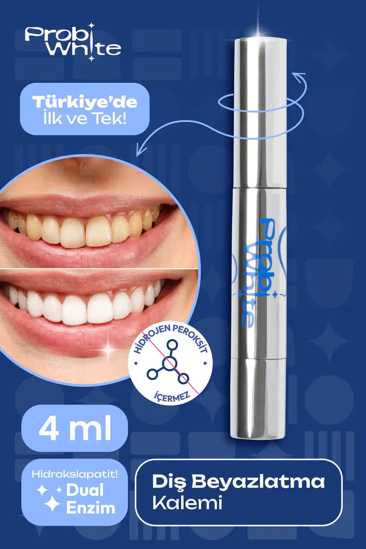 Diş Beyazlatma Kalemi Nedir, Nasıl Kullanılır ve Etkili Mi