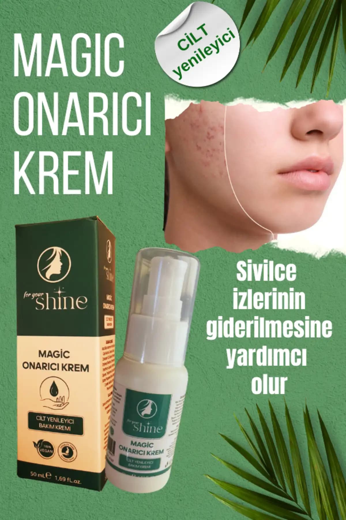 Eczaneden Satılan Sivilce İzi ve Lekelerine En Etkili Kremler Rehberi