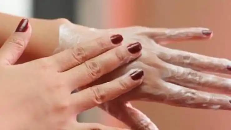 El Çatlaklarına Karşı Etkili Çözüm Yöntemleri ve Bakım Tavsiyeleri