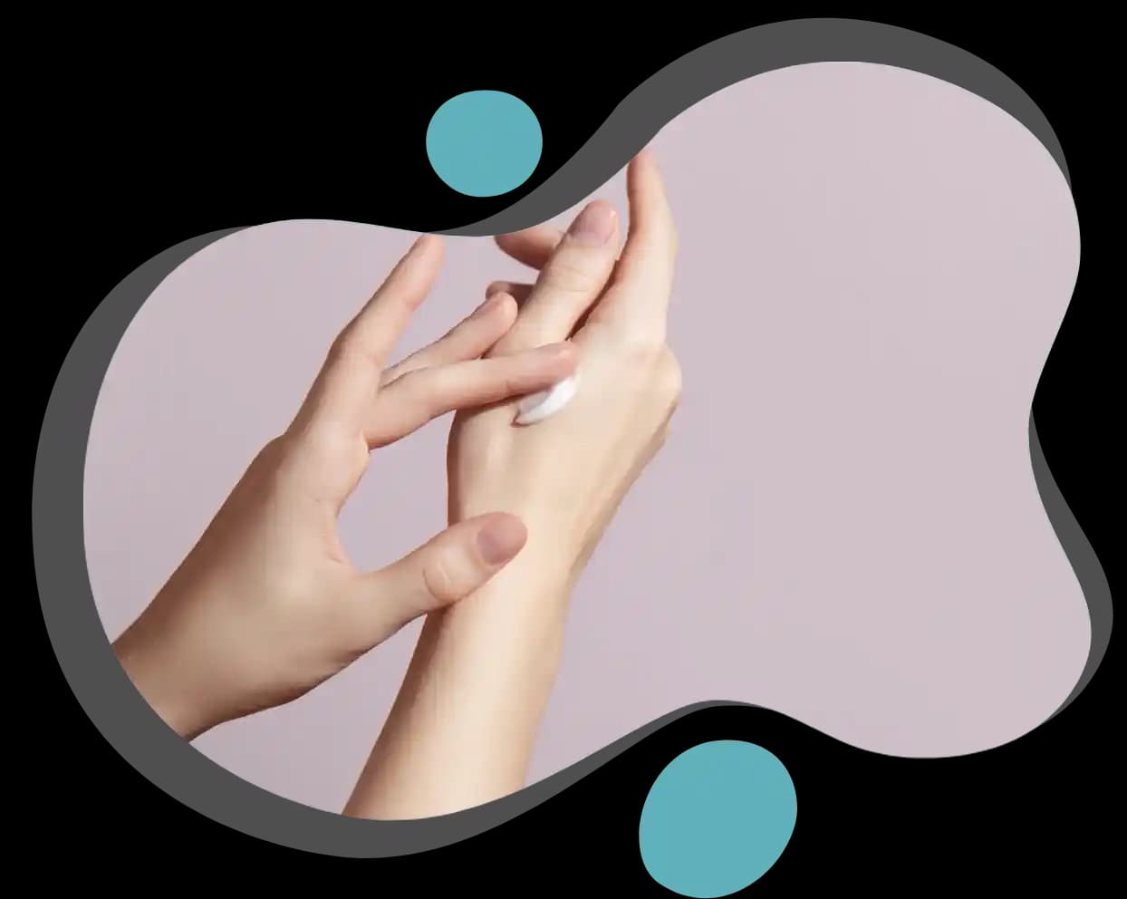 El Çatlaması ve Kanaması Nasıl Önlenir ve Etkili Bakım Yöntemleri Nelerdir