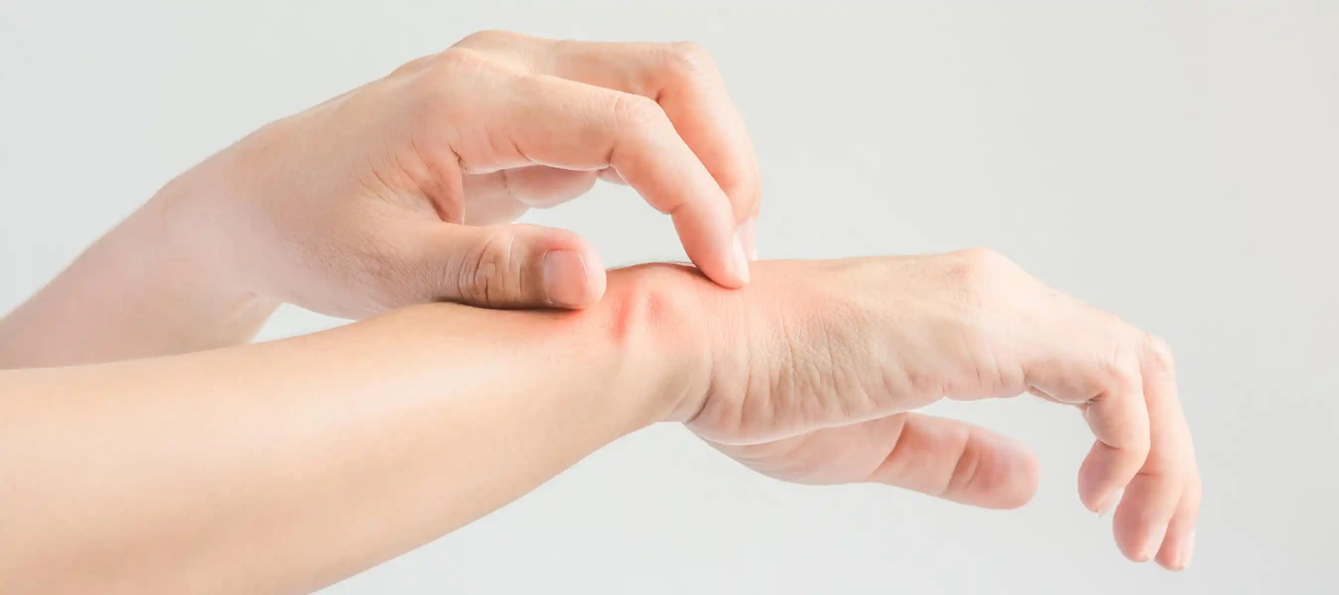 Ellerinizde Yarılma ve Çatlamanın Nedenleri ile Önleme Yöntemleri Hakkında Kapsamlı Bilgi