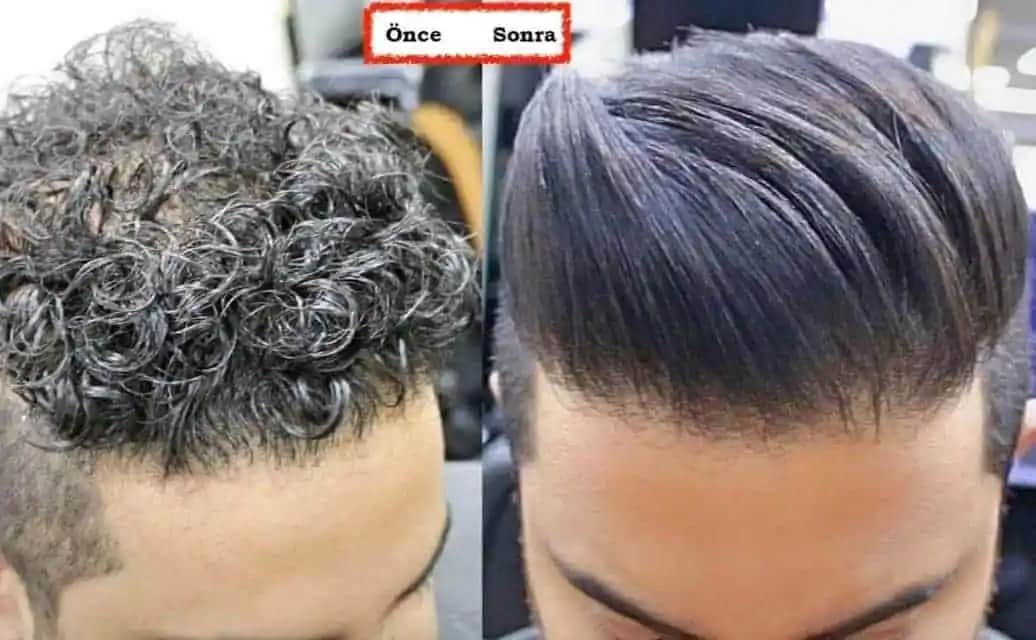 Erkekler İçin Keratin: Saç Sağlığını Güçlendiren Doğal Çözüm ve Bakım İpuçları