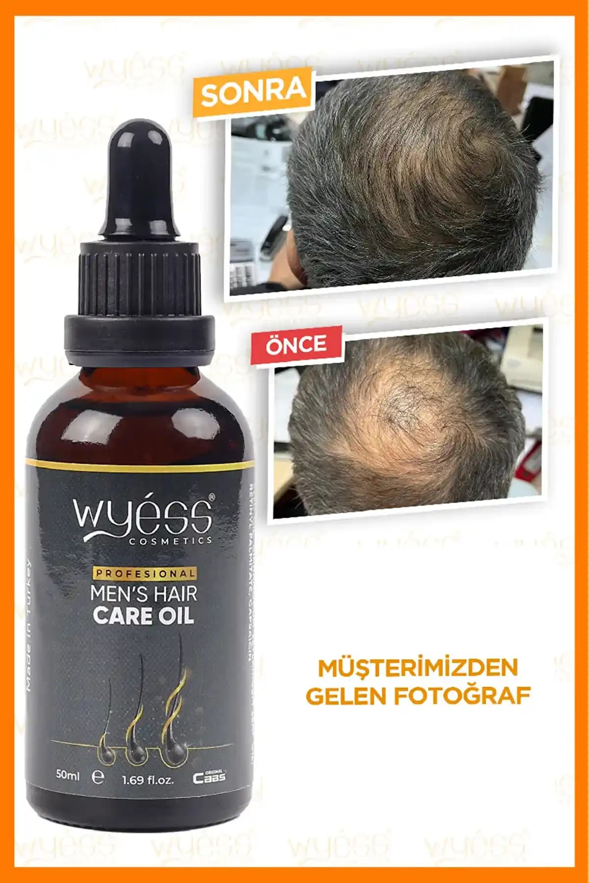 Erkekler İçin Saç Bakım Yağı Kullanımının Önemi ve Doğru Ürün Seçimi