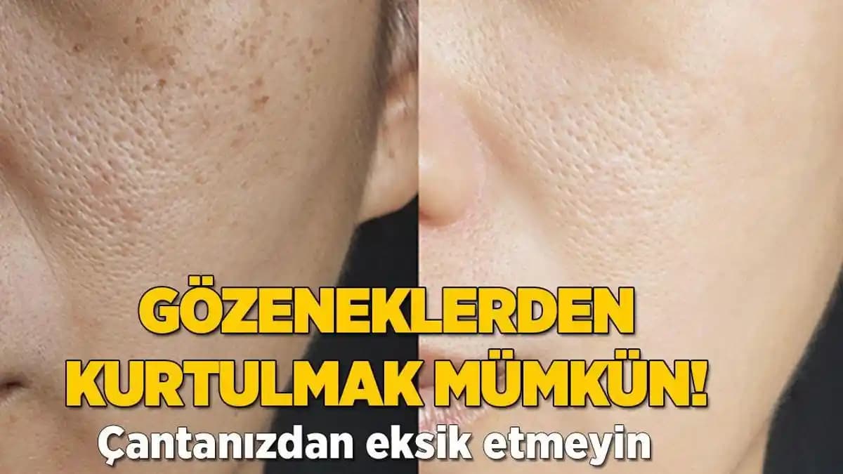 Genişleyen Gözeneklerin Nedenleri ve Etkili Sıkılaştırma Yöntemleri