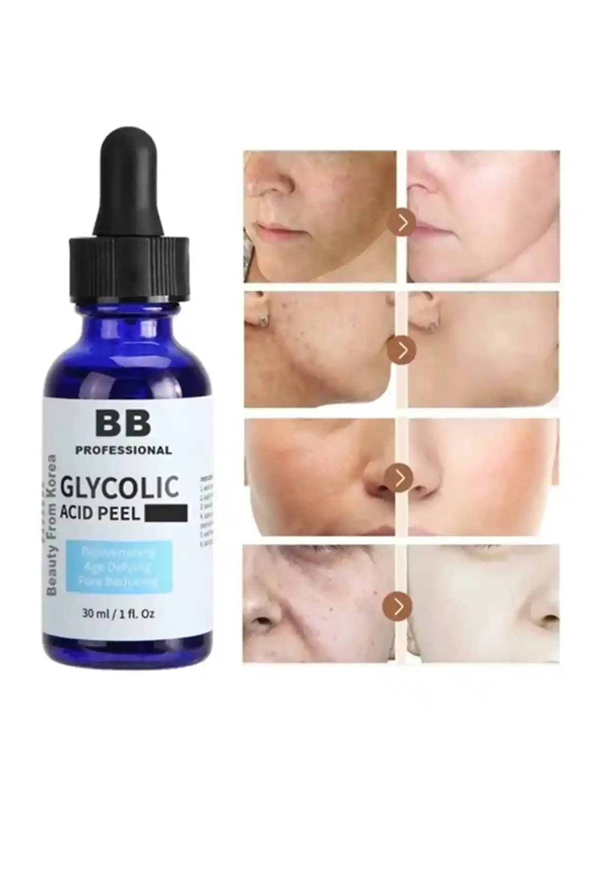 Glikolik Asit Peeling ile Cilt Yenileme ve Güzellikte Etkili Sonuçlar