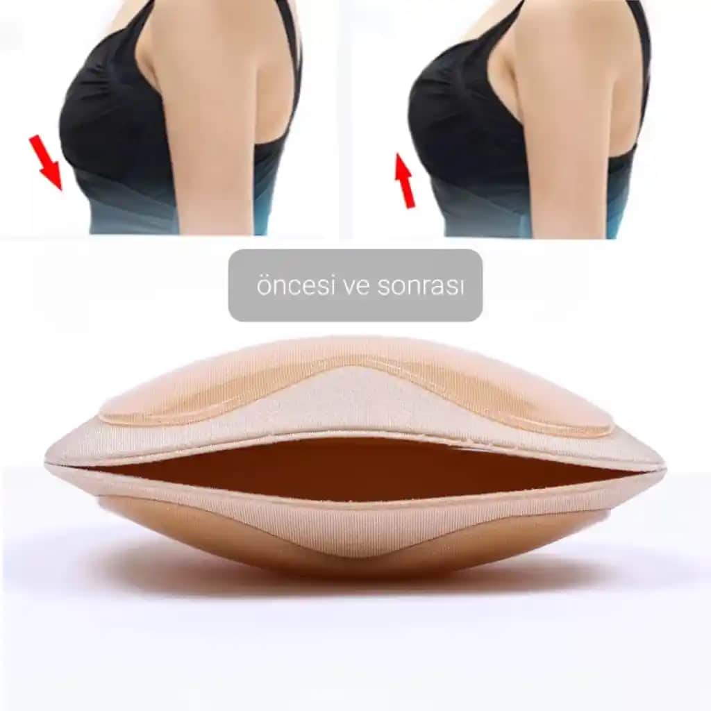 Göğüs Ucu Sivilcesi Nedenleri, Tedavi Yöntemleri ve Koruyucu İpuçları