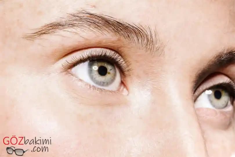 Göz Altı Çizgileri Neden Oluşur ve Etkili Koruma Yöntemleri Nelerdir