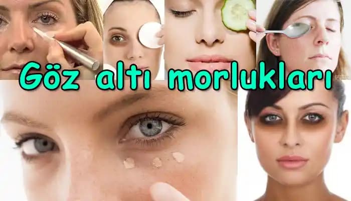 Göz Altı Kırışıklıkları Nasıl Giderilir Uzman Tavsiyeleriyle Çözüm Yolları