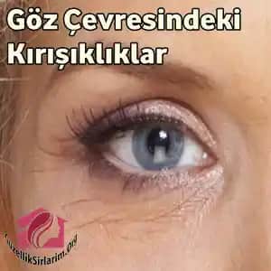 Göz Çevresi Kırışıklıklarını Önleme ve Azaltma Yöntemleri Hakkında Bilgilendirici Rehber
