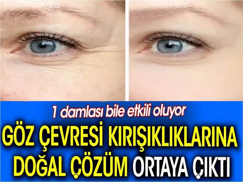 Göz Çevresi Kuruluğu İçin Doğal Çözümler ve Sağlıklı Bakım İpuçları