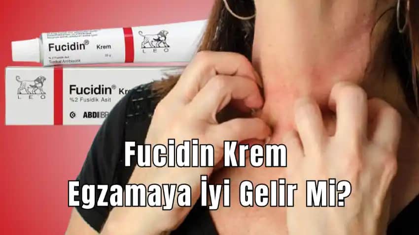 Gözdeki Egzama İçin En Etkili Krem Seçenekleri ve Bakım İpuçları