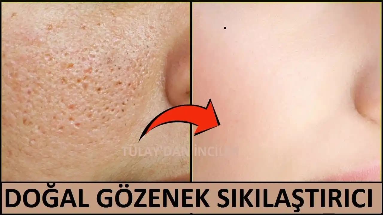 Gözenek Nedir? Yapısı, İşlevleri ve Etkili Bakım Yöntemleri Hakkında Detaylı Bilgi