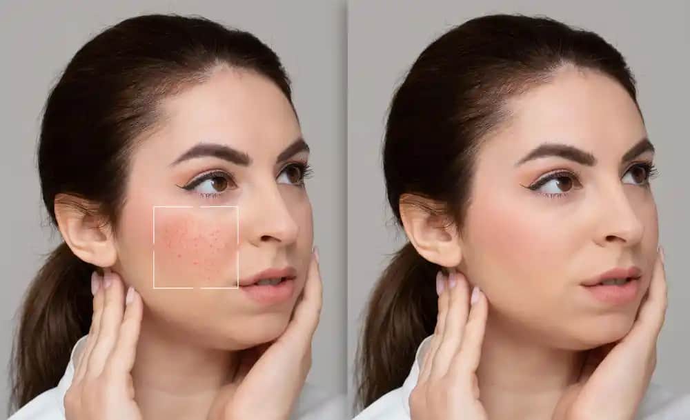 Gözenek Sıkılaştırma Yöntemleri ve Cilt Sağlığını Artıran Uygulamalar