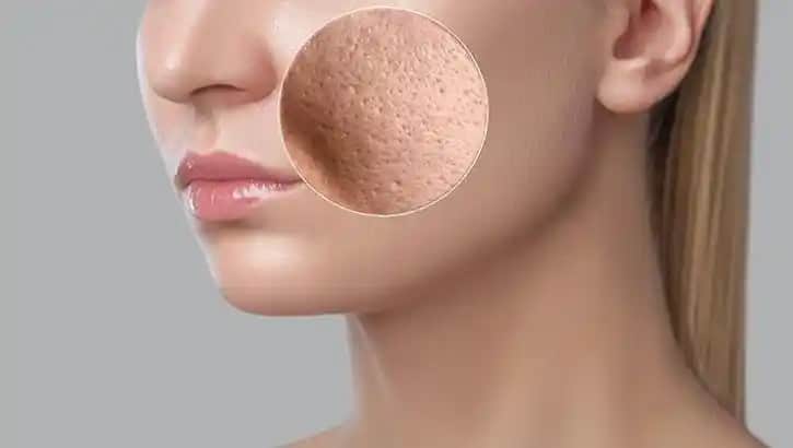 Gözenekli Cilt Bakımı ve Doğru Ürün Seçimi İpuçlarıyla Sağlıklı Cilt Yaratın