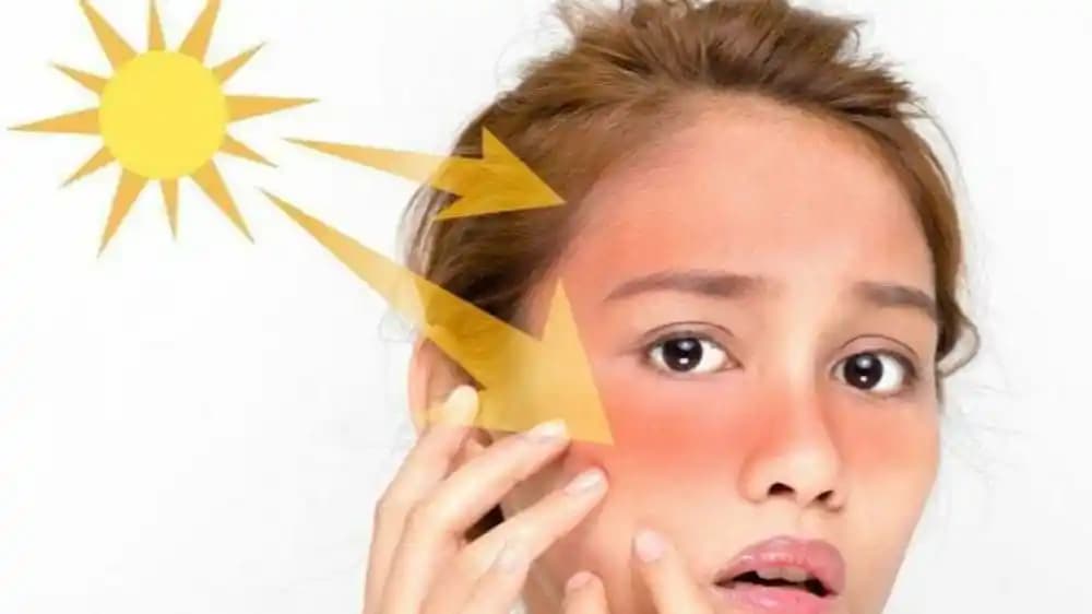 Güneşin Cilde Zararları ve Korunma Yöntemleri: Bilinçli Güneş Kullanımı İçin Rehber